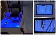 A hajmosás, amely minden pénzt megér! – Head spa szolgáltatás Ipolyságon